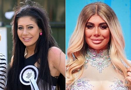 chloe g shore then and now|geordie shore before and after.